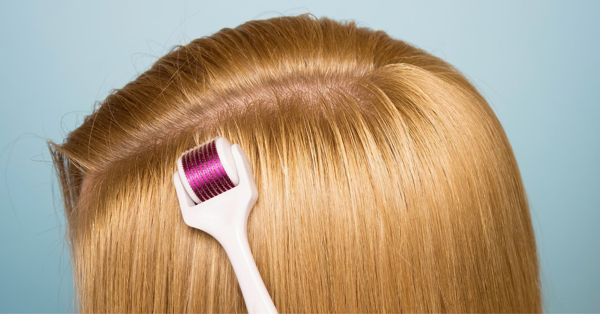 Hand and mesoroller in hand on a blue background. Scalp and skin care, healthy hair